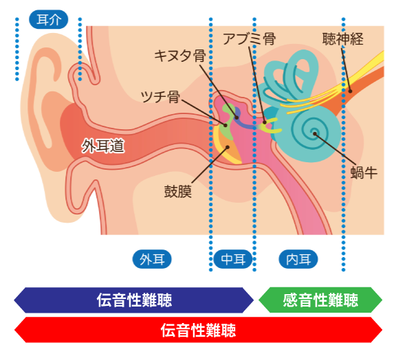 聞こえの仕組みと難聴