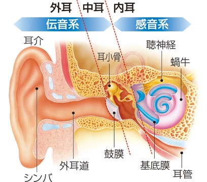 伝音難聴