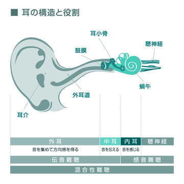 補聴器説明 骨伝導補聴器